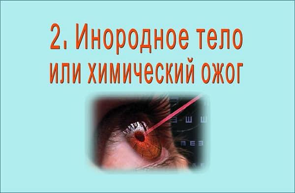 Ожег глаз