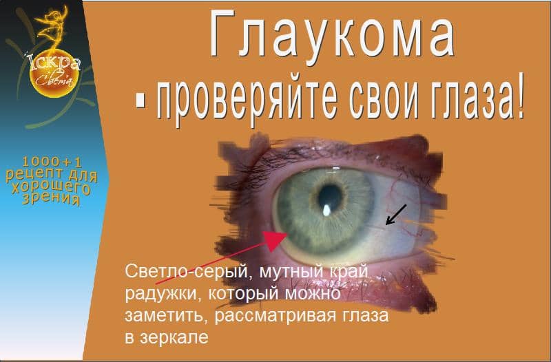 Как проверить глаза на глаукому