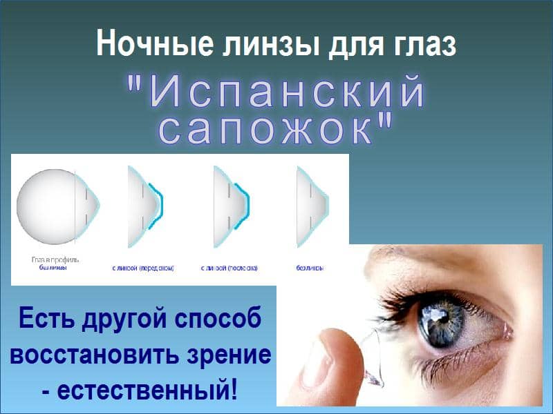 Ночные линзы для восстановления зрения детям отзывы. Ночные ортокератологические линзы. Ортокератология ночные линзы. Ночные линзы для восстановления зрения. Исправление зрения линзами.